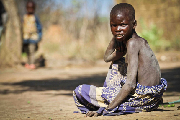 Hopeless as the situation may seem, Odongkara does not want to lose hope. It is easy to see that he deeply loves his daughter, even in her state. Memories of the good old days before Lamwaka fell ill are still fresh in his mind. He says she was a cheerful, loving and responsible child who took good care of her siblings and drew only excellent reports from her teachers at school.