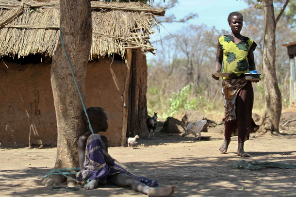 Food is Lamwaka’s worst tormentor. She can live with the pain, with the loneliness, with her ugly wounds, but not with food. Children affected by the disease are known to repel sights of food or its smell.