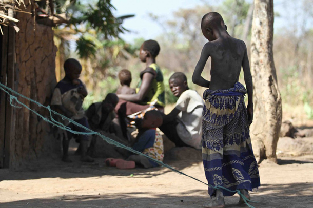 Her siblings stay away from her most of the time and look on curiously from a distance for fear of contracting the disease, known to affect children aged between 0 and 15 years.
