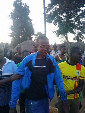 Three Hacked in Gulu A Day After Crowd Lynched Suspected Thugs