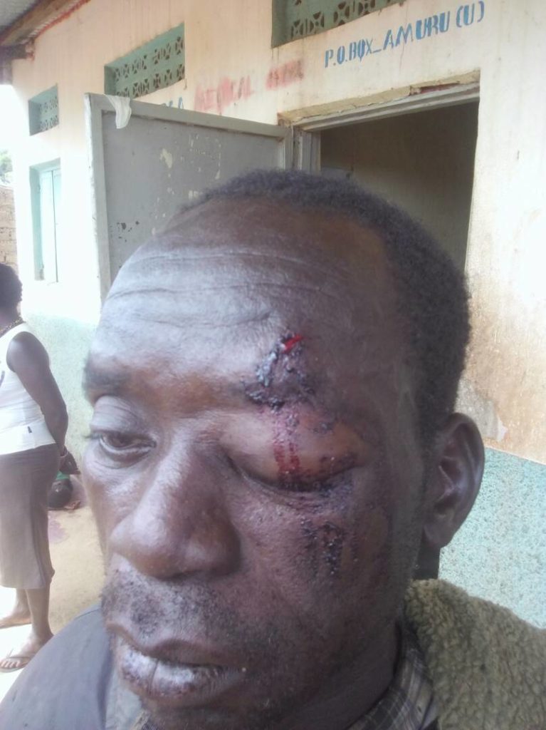 Death Toll From Apaa Tribal Clash Rises To Three, 19 Inured